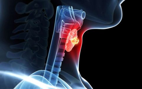 Thyroid