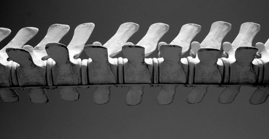 Find A Professional Chiropractor In Burlington